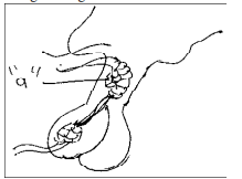 NEET_UG_physics_057