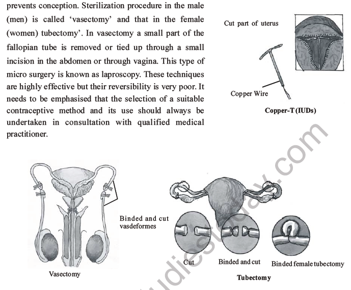 NEET Biology Reproductive Health MCQs Set A-3