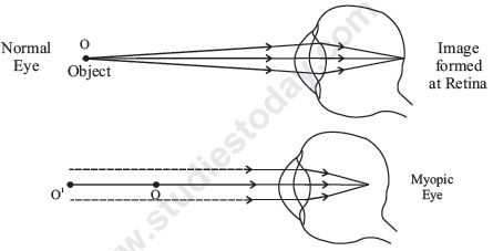 CBSE Class 10 Science The Hyman Eye and the Colourful World