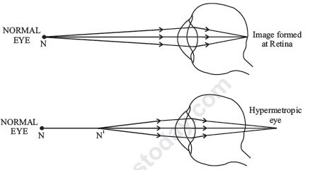 CBSE Class 10 Science The Hyman Eye and the Colourful World