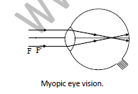 Class 10 Science Human Eye and Colourful World Exam Notes