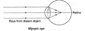 NCERT Exemplar Solutions Class 10 Science Human Eye and Colourful World