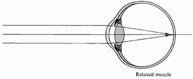 cbse-class-10-physics-the-human-eye-and-the-colorful-world-worksheet-set-f-solved