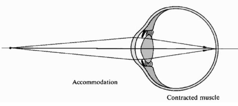 cbse-class-10-physics-the-human-eye-and-the-colorful-world-worksheet-set-f-solved