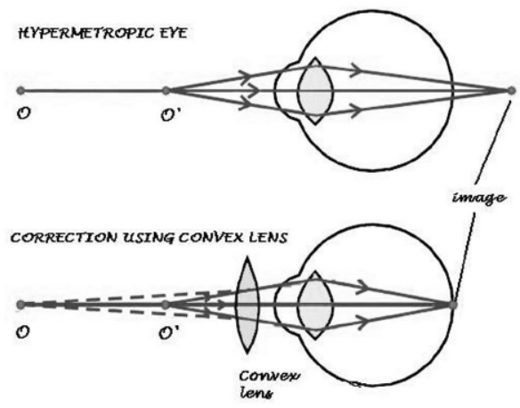 cbse-class-10-physics-the-human-eye-and-the-colorful-world-worksheet-set-f-solved