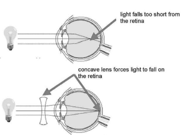 cbse-class-10-physics-the-human-eye-and-the-colorful-world-worksheet-set-f-solved