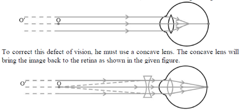 cbse-class-10-physics-the-human-eye-and-the-colorful-world-worksheet-set-f-solved