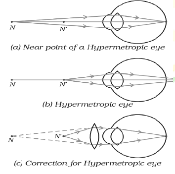 CBSE Class 10 Physics The Human Eye and The Colorful World