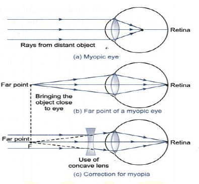CBSE Class 10 Physics The Human Eye and The Colorful World
