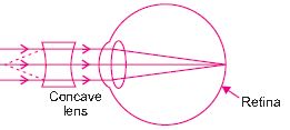 ""CBSE-Class-10-Science-The-Human-Eye-and-the-Colourful-World-6