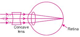 ""CBSE-Class-10-Science-The-Human-Eye-and-the-Colourful-World