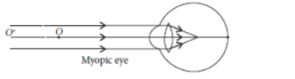 CBSE-Class-10-Science-Human-Eye-and-Colorful-World-Assignment-Set-E-11