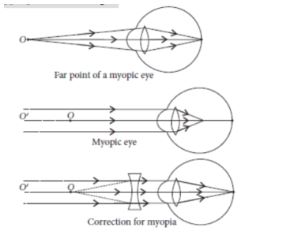 CBSE-Class-10-Science-Human-Eye-and-Colorful-World-Assignment-Set-E-15