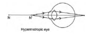 CBSE-Class-10-Science-Human-Eye-and-Colorful-World-Assignment-Set-E-8