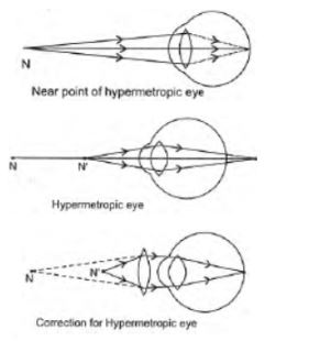 CBSE-Class-10-Science-Human-Eye-and-Colorful-World-Assignment-Set-E