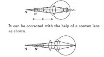 CBSE-Class-10-Science-Human-Eye-and-Colorful-World-Assignment-Set-F-2
