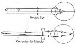 CBSE-Class-10-Science-Human-Eye-and-Colorful-World-Assignment-Set-F-3