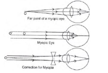 CBSE-Class-10-Science-Human-Eye-and-Colorful-World-Assignment-Set-F