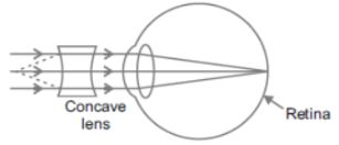 CBSE-Class-10-Science-The-Human-Eye-and-the-Colourful-World-MCQs-Set-E-1