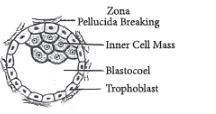 CBSE-Class-12-Biology-Human-Reproduction-Assignment-Set-D-6